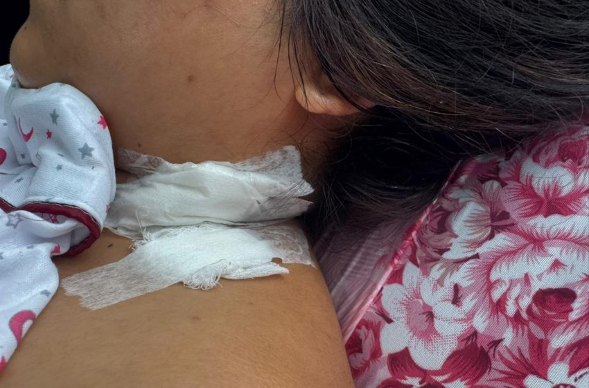  Presunto feminicida escapa tras apuñalar a su expareja en La Esperanza